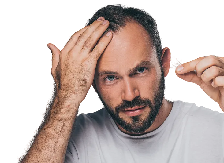 bearded-middle-aged-man-holding-fallen-hair-and-lo-2024-11-17-09-22-03-utc 1